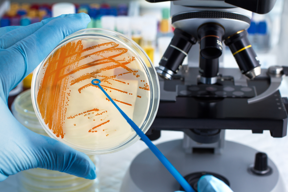 avoid microbial failings